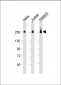 CAD Antibody (Center)